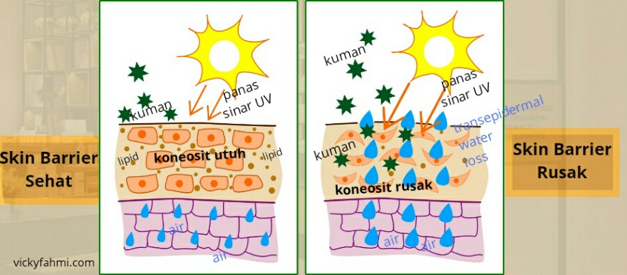kulit sehat dengan skin barrier utuh dan hilangnya fungsi ceramide pada kulit